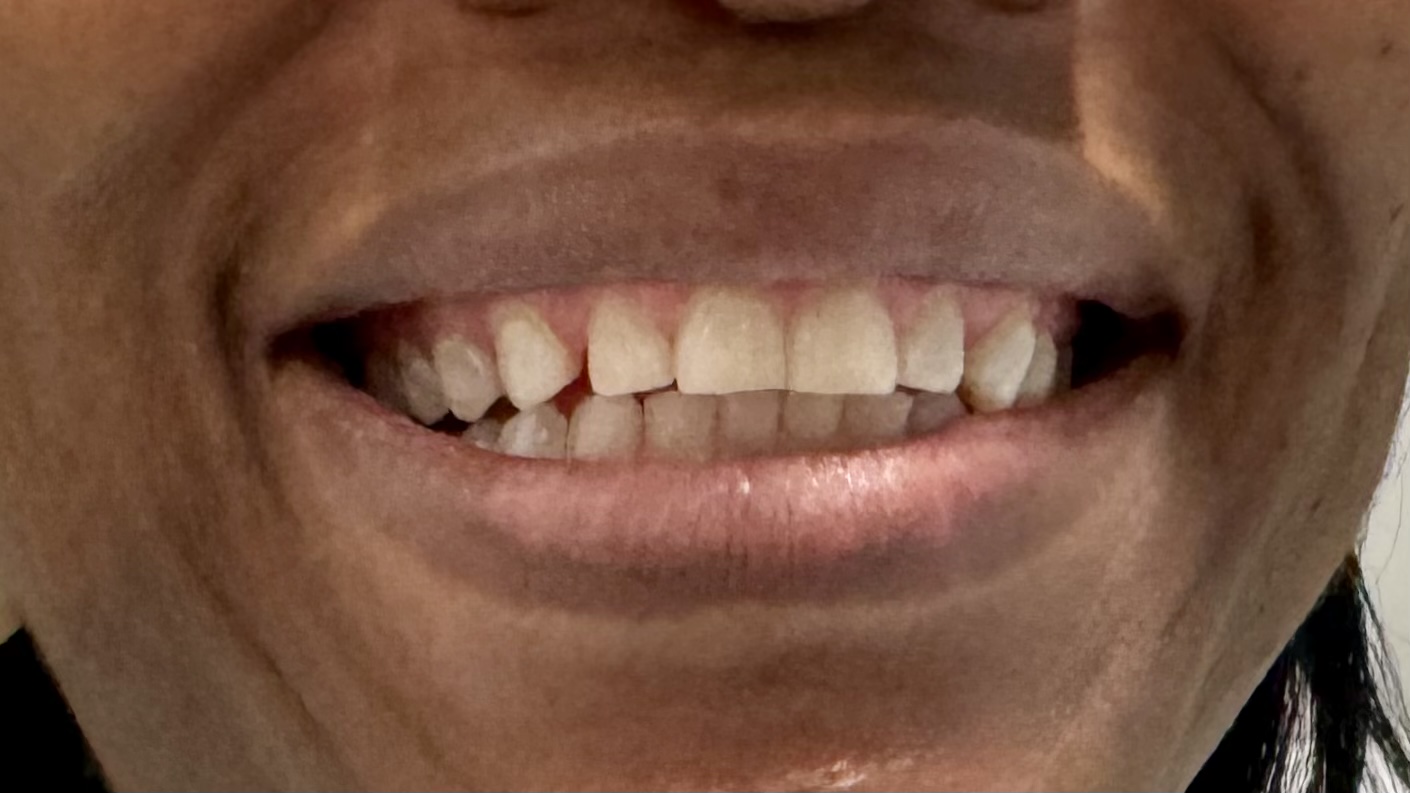 Dentist in Mt Vernon, NY