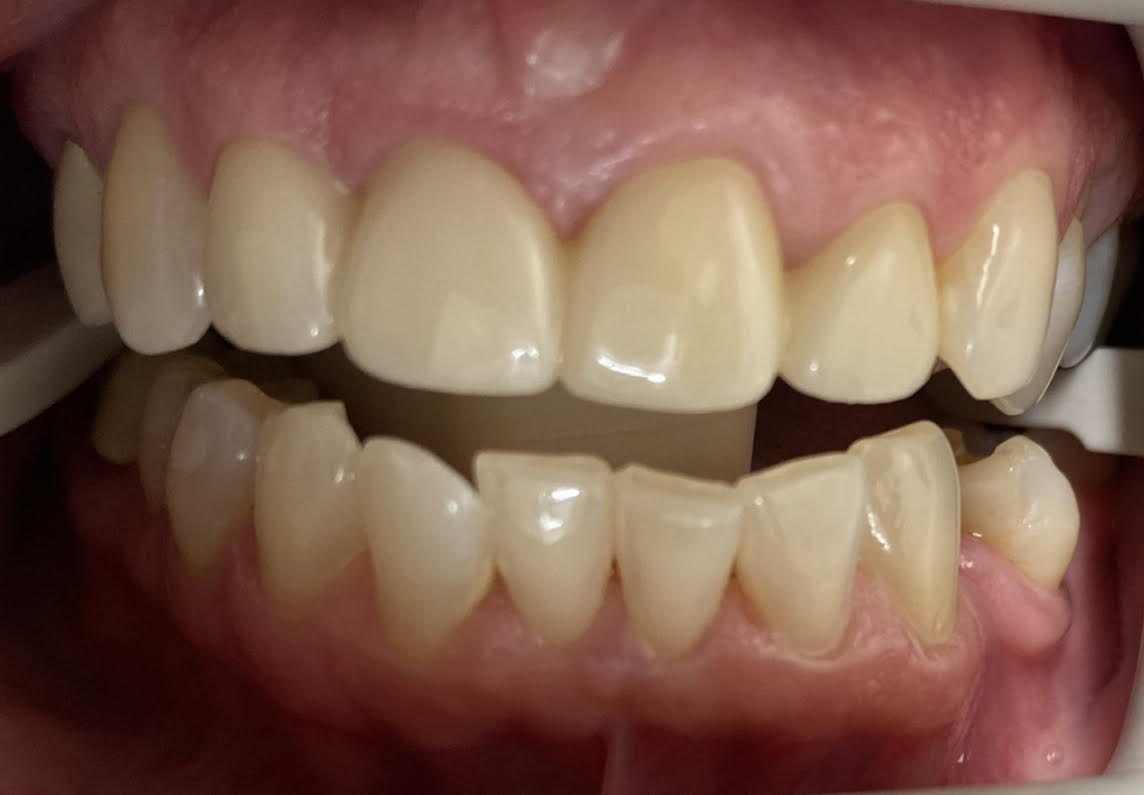 Dentist in Mt Vernon, NY