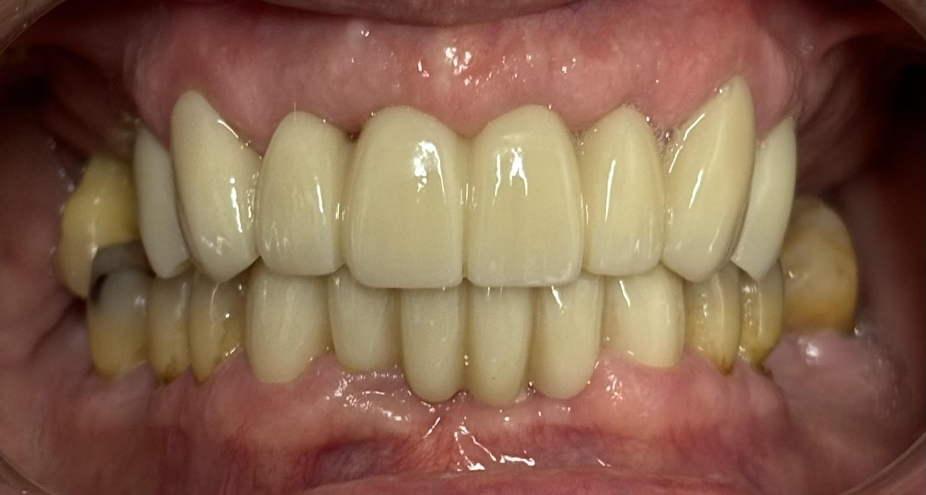 Dentist in Mt Vernon, NY