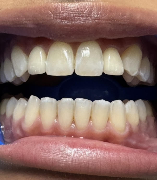 Dentist in Mt Vernon, NY