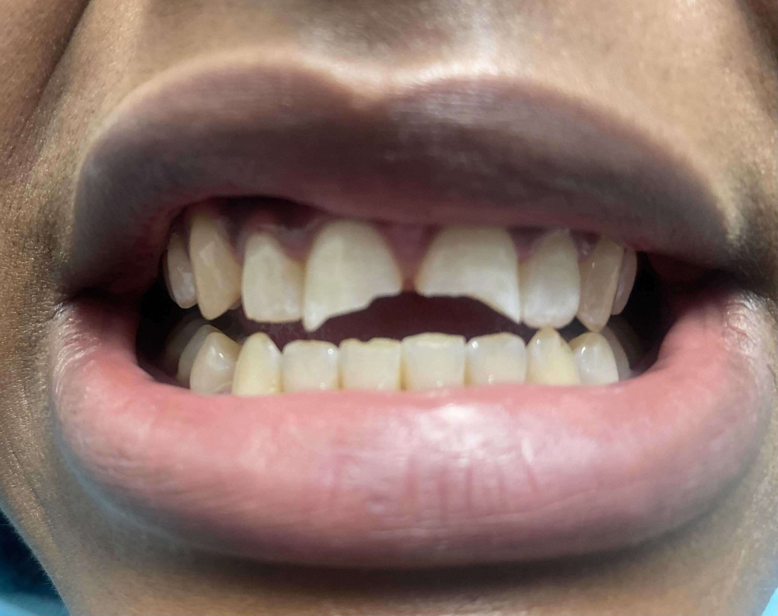 Dentist in Mt Vernon, NY
