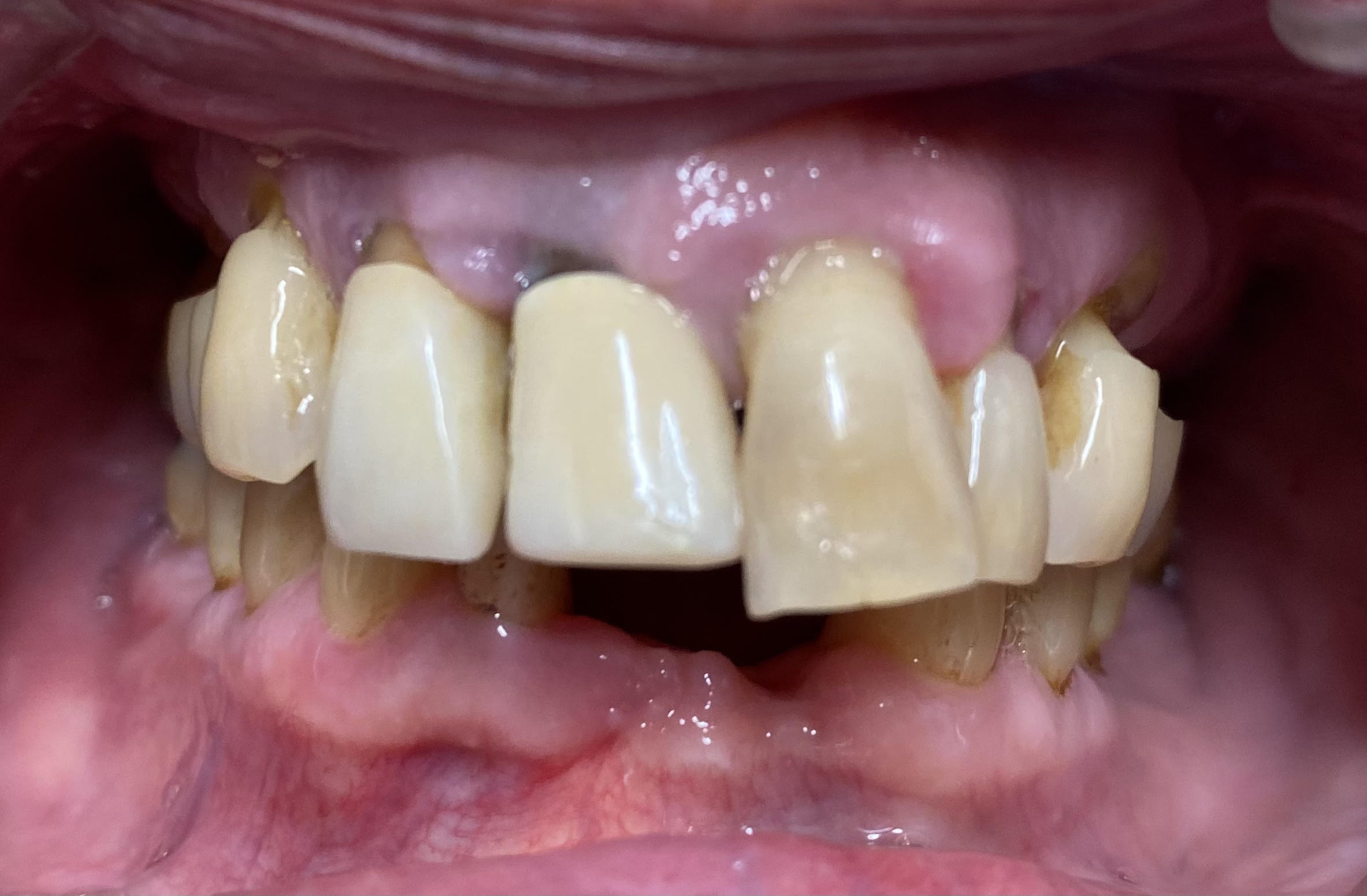 Dentist in Mt Vernon, NY