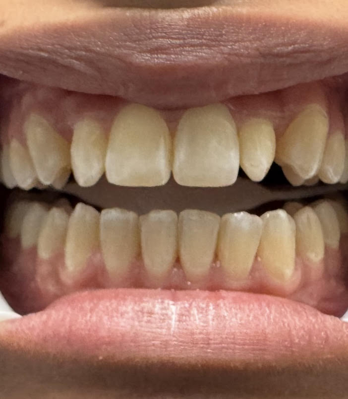 Dentist in Mt Vernon, NY