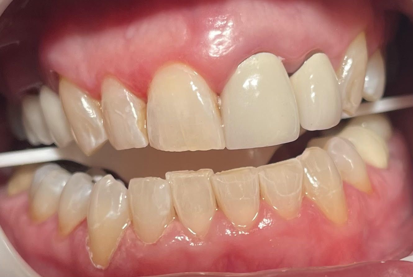 Dentist in Mt Vernon, NY