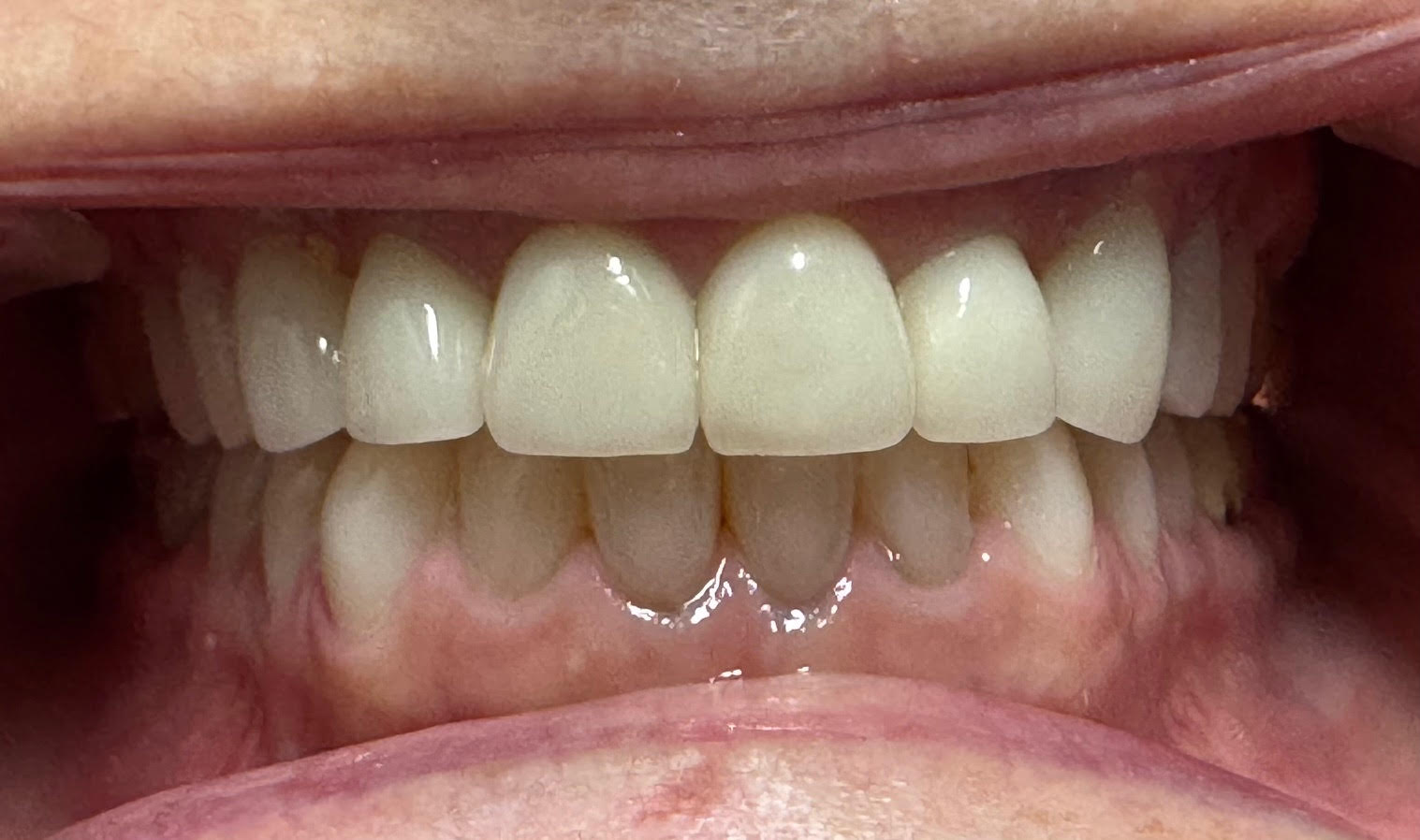 Dentist in Mt Vernon, NY