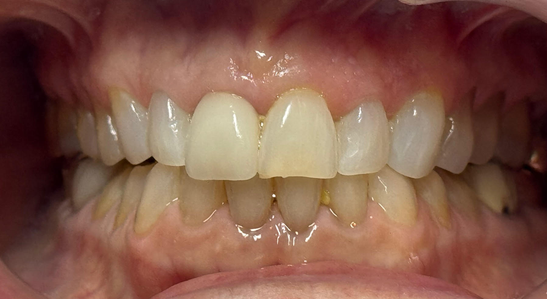 Dentist in Mt Vernon, NY