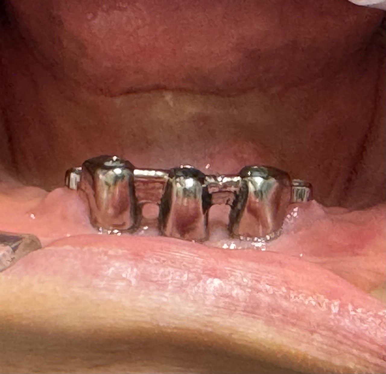 Dentist in Mt Vernon, NY