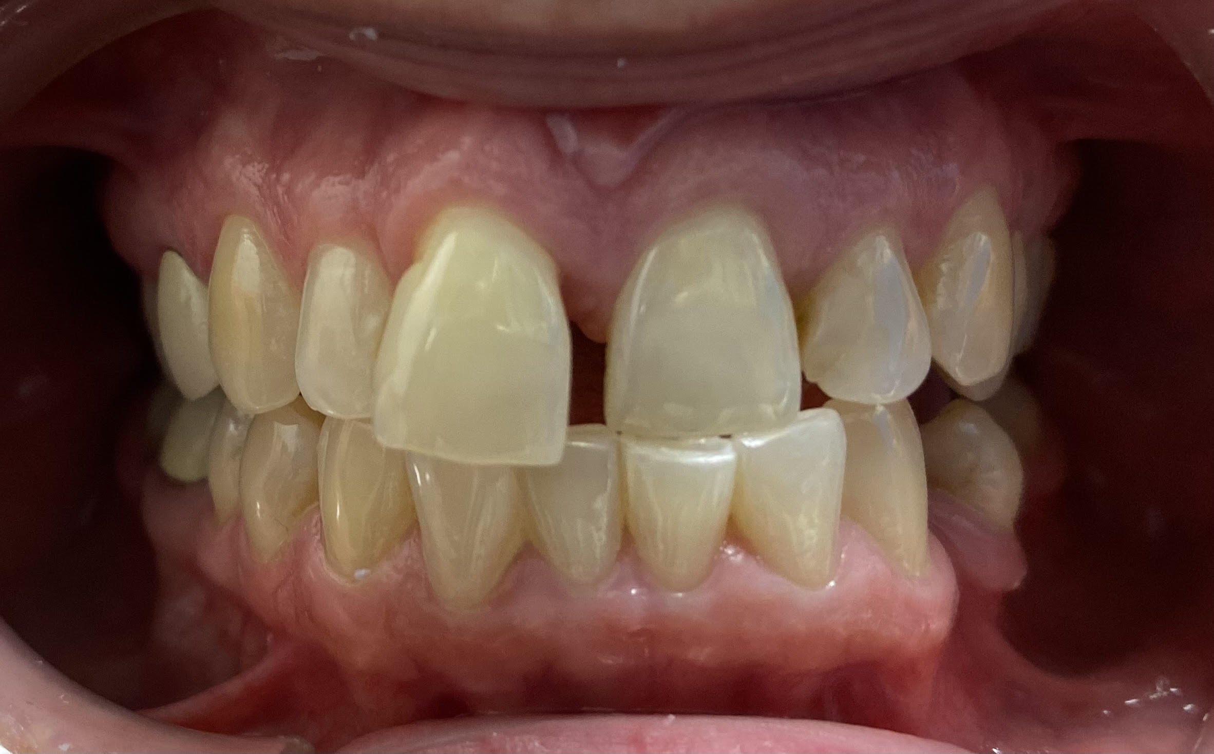 Dentist in Mt Vernon, NY